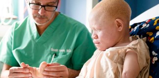 Niños albinos cazados en África tienen esperanza en EE. UU