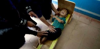 Sesan: Obesidad y sobrepeso se deben a desnutrición