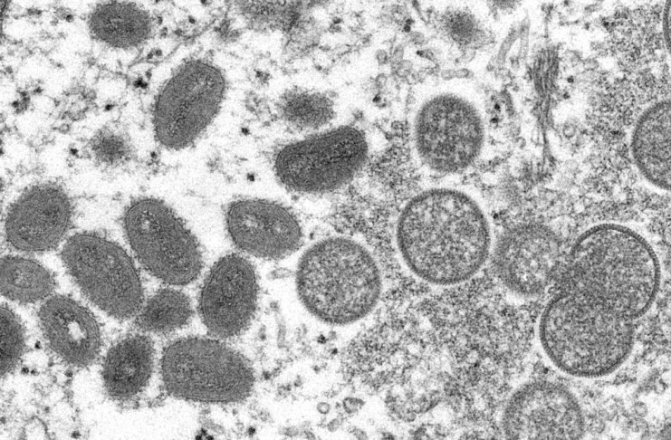Raros brotes de viruela del mono detectados en Norteamérica y Europa