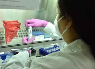 El Laboratorio Nacional de Salud ya analiza las muestras extraídas de los pacientes que han presentado enfermedad neurológica aguda. Foto: MSPAS/La Hora