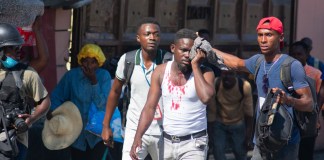 Un periodista herido recibe ayuda después de que, según informes, fue alcanzado por un bote de gas lacrimógeno disparado por la policía en Puerto Príncipe, Haití, el 9 de marzo de 2024. Foto: AFP.