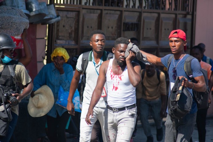 Un periodista herido recibe ayuda después de que, según informes, fue alcanzado por un bote de gas lacrimógeno disparado por la policía en Puerto Príncipe, Haití, el 9 de marzo de 2024. Foto: AFP.