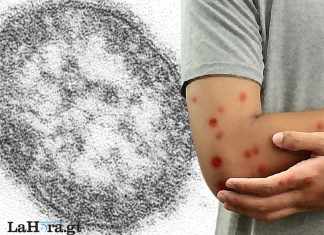 Arte: Alejandro Ramirez/La Hora