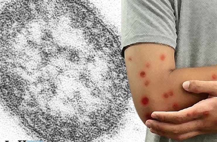 Arte: Alejandro Ramirez/La Hora