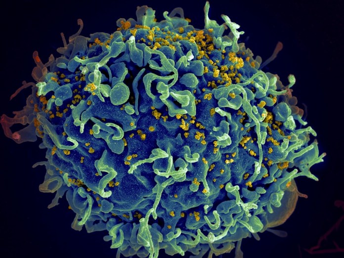 Esta imagen de un microscopio electrónico proporcionada por los Institutos Nacionales de Salud de Estados Unidos muestra una célula humana T, en azul, atacada por virus del VIH, el virus que causa el sida, en amarillo. (Seth Pincus, Elizabeth Fischer, Austin Athman/Instituto Nacional de Alergia y Enfermedades Infecciosas/NIH via AP, Archivo)