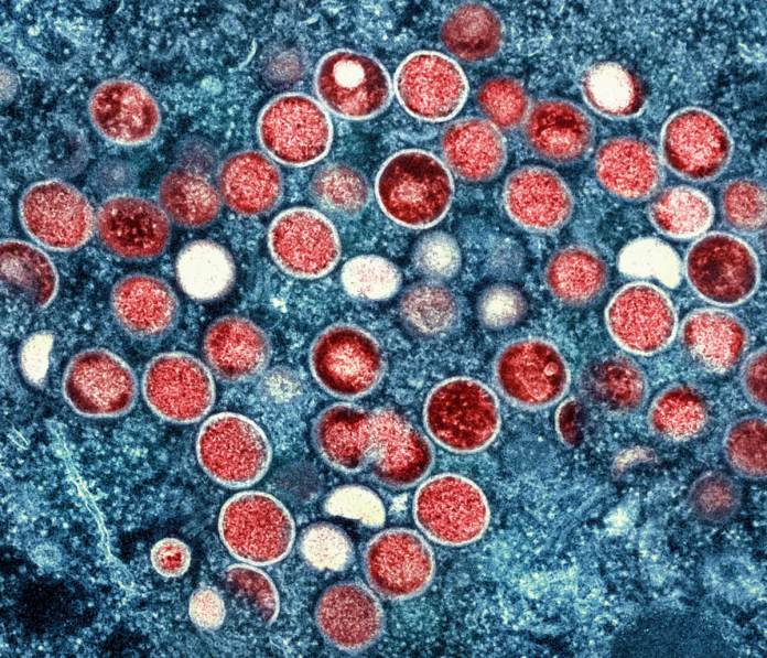 Esta imagen, proporcionada por el Instituto Nacional de Enfermedades Alérgicas e Infecciosas de Estados Unidos (NIAID, por sus siglas en inglés), muestra una micrografía electrónica de transmisión coloreada de partículas de viruela símica (rojo) que se encuentran dentro de una célula infectada (azul), cultivada en el laboratorio, que fue capturada y coloreada en el Centro Integrado de Investigación del NIAID, en Fort Detrick, Maryland (NIAID vía AP, Archivo).