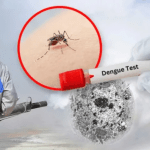 Dengue