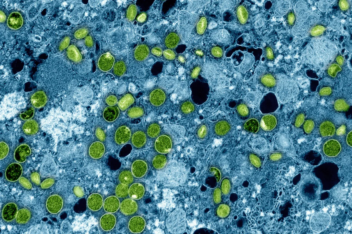 Esta imagen coloreada de microscopio electrónico proporcionada por el Instituto Nacional de Alergias y Enfermedades Infecciosas en 2024 muestra partículas del virus de la viruela, de color verde, encontradas dentro de células cultivadas infectadas, de color azul. Foto: La Hora/ AP- Archivo