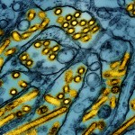 Foto de microscopio difundida por el Instituto Nacional de Alergias y Enfermedades Infecciosas de Estados Unidos el 26 de marzo del 2024, que muestra partículas de la gripe aviar. Foto La Hora: AP