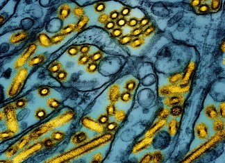 Foto de microscopio difundida por el Instituto Nacional de Alergias y Enfermedades Infecciosas de Estados Unidos el 26 de marzo del 2024, que muestra partículas de la gripe aviar. Foto La Hora: AP