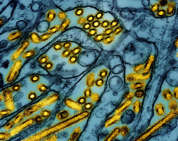 En esta imagen iluminada de un microscopio de electrones difundida por el Instituto Nacional de Alergias y Enfermedades Infecciosas el 26 de marzo de 2024, se muestran partículas del virus de influenza aviar A H5N1, en amarillo, en células epiteliales Foto La Hora: AP