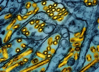 En esta imagen iluminada de un microscopio de electrones difundida por el Instituto Nacional de Alergias y Enfermedades Infecciosas el 26 de marzo de 2024, se muestran partículas del virus de influenza aviar A H5N1, en amarillo, en células epiteliales Foto La Hora: AP