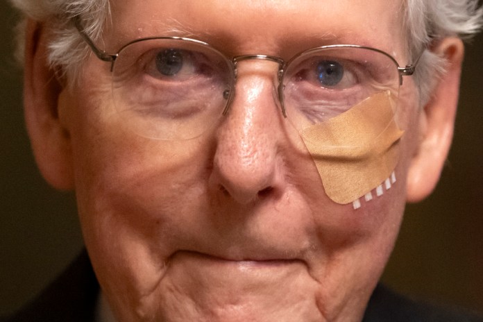 El líder de los republicanos en el Senado Mitch McConnell, con una venda en la cara debido a una caída, en el Congreso en Washington el 10 de diciembre del 2024.. Foto La Hora: AP