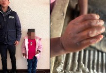 PGN rescata a niña con quemaduras en las manos presuntamente por no realizar las tareas del hogar