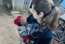 Niño de 11 meses con desnutrición y problemas de salud es rescatado por PGN