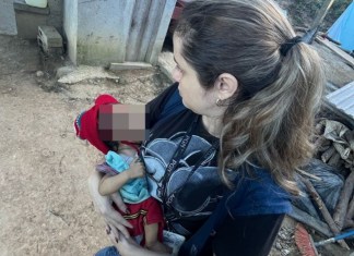 Niño de 11 meses con desnutrición y problemas de salud es rescatado por PGN