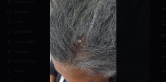 Bala perdida impacta contra el cráneo de una mujer de la tercera edad en Mixco