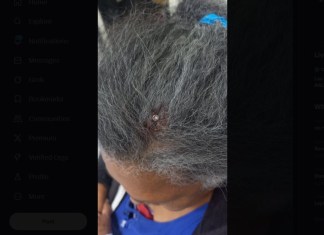 Bala perdida impacta contra el cráneo de una mujer de la tercera edad en Mixco