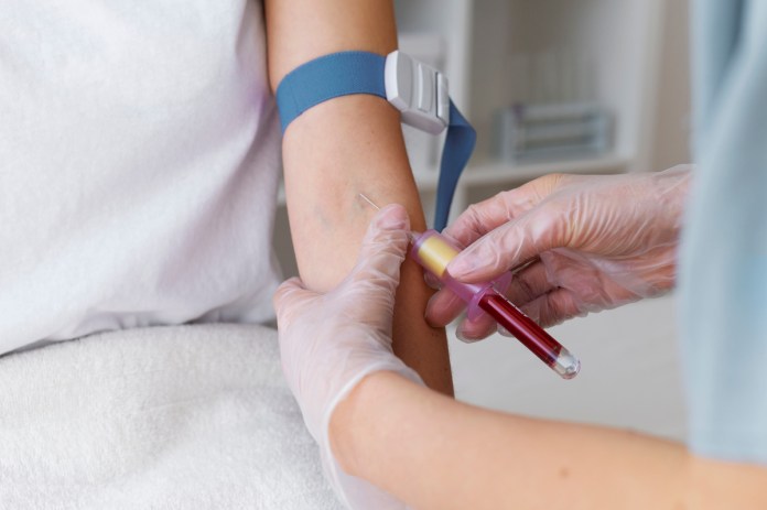 Bancos de Sangre: requisitos y cómo prepararse para una donación segura