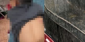 Menor de edad herido en Jalapa mientras viajaba en un tuctuc. Foto La Hora: ASONBOMD