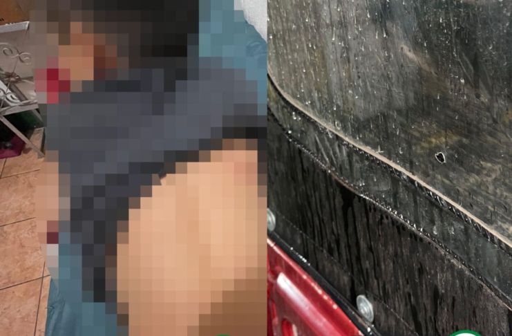 Menor de edad herido en Jalapa mientras viajaba en un tuctuc. Foto La Hora: ASONBOMD