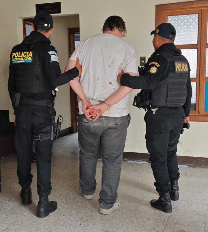 Violento ataque dentro de hotel en Antigua