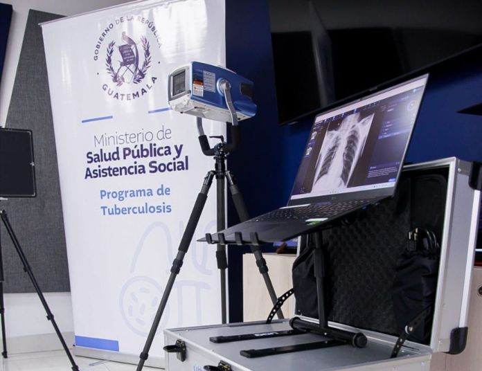 Con el equipo de rayos X se busca detectar y prevenir a tiempo la Tuberculosis. Foto La Hora: Ministerio de Salud