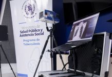 Con el equipo de rayos X se busca detectar y prevenir a tiempo la Tuberculosis. Foto La Hora: Ministerio de Salud