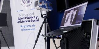 Con el equipo de rayos X se busca detectar y prevenir a tiempo la Tuberculosis. Foto La Hora: Ministerio de Salud
