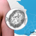 El Ministerio de Salud contabiliza 868 casos de sarampión y ha lanzado una campaña de vacunación para buscar frenar la enfermedad viral.