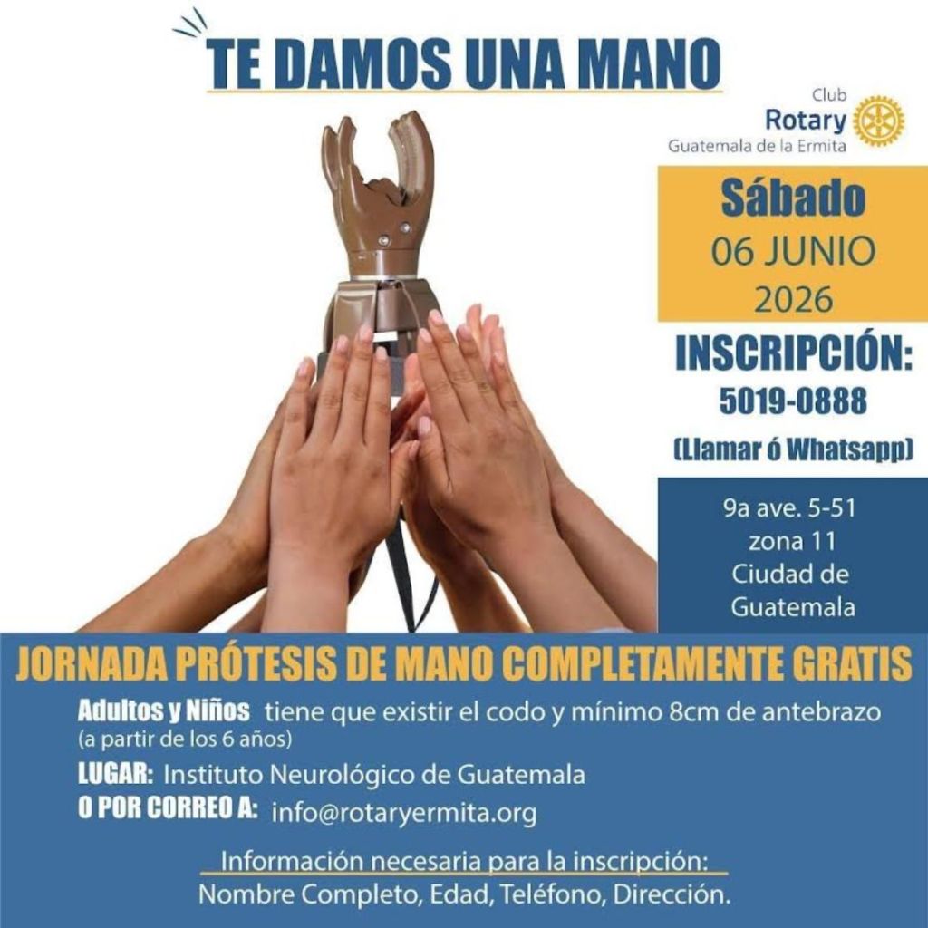 Donarán prótesis de mano a niños y adultos que las necesiten en Guatemala