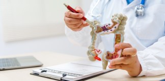 El estreñimiento crónico puede derivar en más molestias. Foto: PanuShot / Shutterstock.