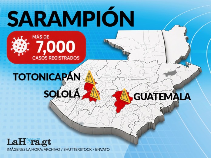 Actualización de casos y fallecidos por sarampión en Guatemala. Foto: La Hora/ Envato