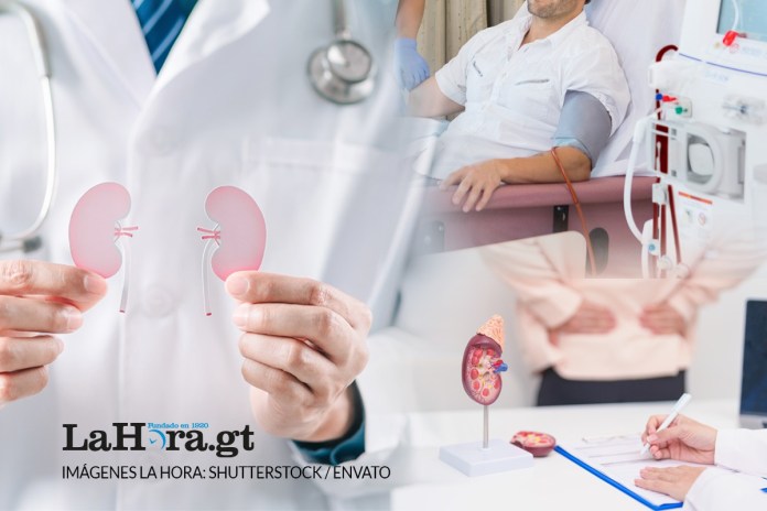 Enfermedad renal cronica presenta 30 casos al dia