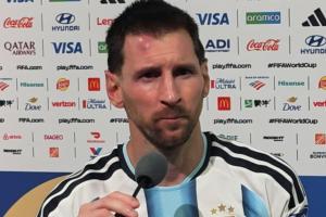 Messi muestra una inflamación en la frente. 