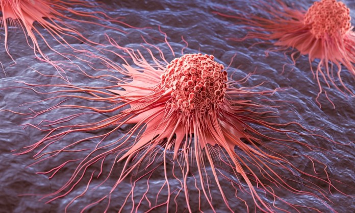 El cáncer puede ser diferente entre personas, aún cuando está en el mismo órgano. Foto: Anusorn Nakdee / Shutterstock.