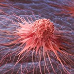 El cáncer puede ser diferente entre personas, aún cuando está en el mismo órgano. Foto: Anusorn Nakdee / Shutterstock.