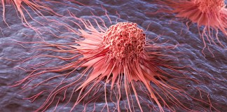El cáncer puede ser diferente entre personas, aún cuando está en el mismo órgano. Foto: Anusorn Nakdee / Shutterstock.