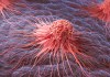 El cáncer puede ser diferente entre personas, aún cuando está en el mismo órgano. Foto: Anusorn Nakdee / Shutterstock.