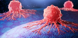 Las células cancerígenas se vuelven más agresivas cuando falta oxígeno, según el estudio. Foto: Anusorn Nakdee / Shutterstock.