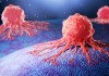 Cómo aprende el cáncer a sobrevivir sin oxígeno Las células cancerígenas se vuelven más agresivas cuando falta oxígeno, según el estudio. Foto: Anusorn Nakdee / Shutterstock.
