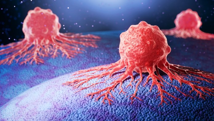 célula cáncer Las células cancerígenas se vuelven más agresivas cuando falta oxígeno, según el estudio. Foto: Anusorn Nakdee / Shutterstock.